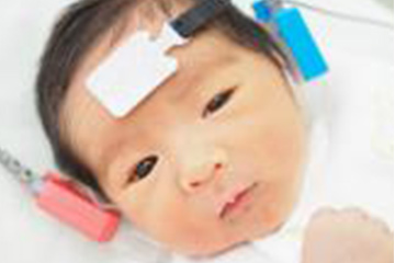 新生児聴力検査